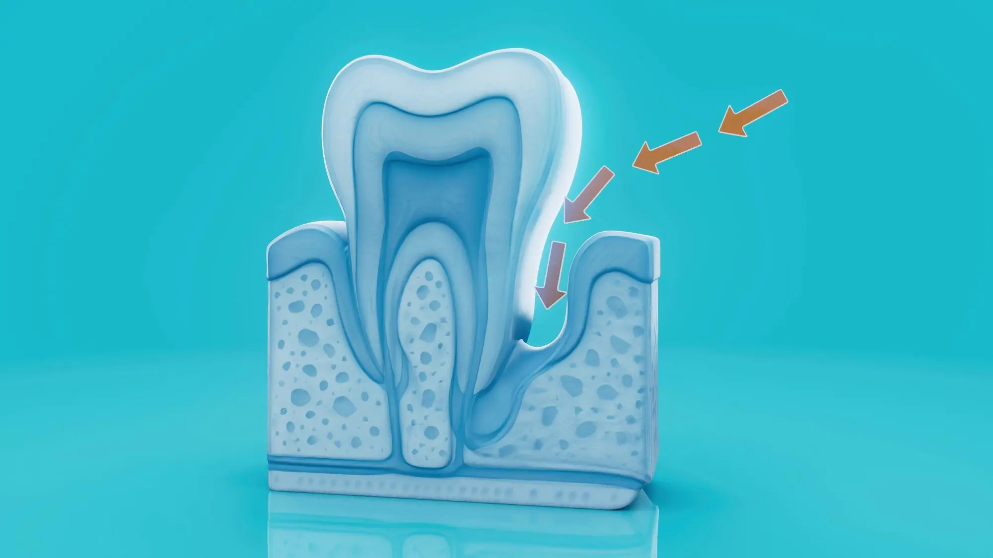 تقوية جذور الاسنان
