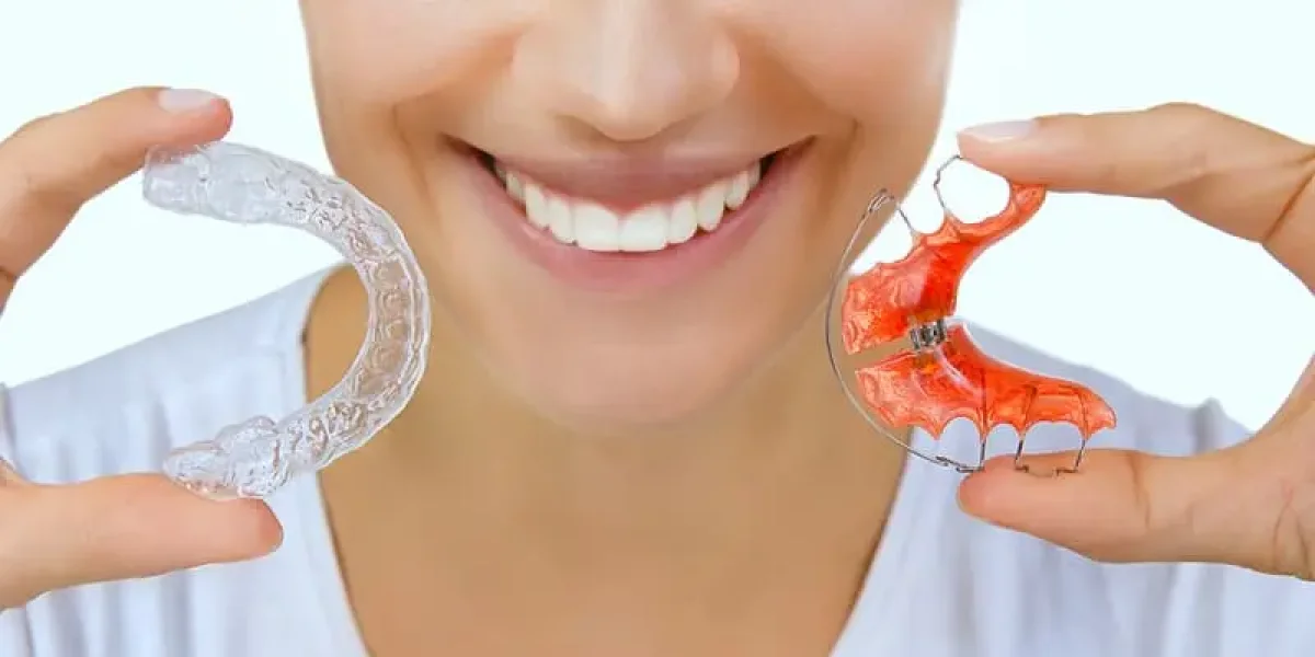 أنواع مثبت الأسنان بعد التقويم